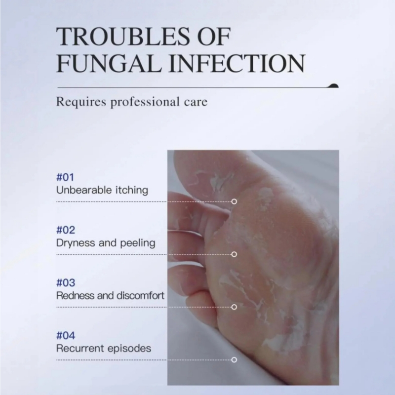 KORMESIC Foot Antifungal Cream – Fast Relief Foot Fungal Infections | Relieves Itching Soothes Peeling Skin & Reduces Redness | OTC Topical Treatment for Toe & Foot Fungus | Effective Daily Foot Care
