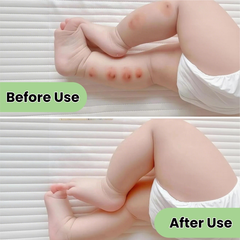 KORMESIC Mosquito Repellent Spray - Long-Lasting Protection Stops Itching & Skin Cooling - Gentle Formula Non-Greasy Pleasant Fragrance - Family Friendly for All Ages - Effective Mosquito Protection