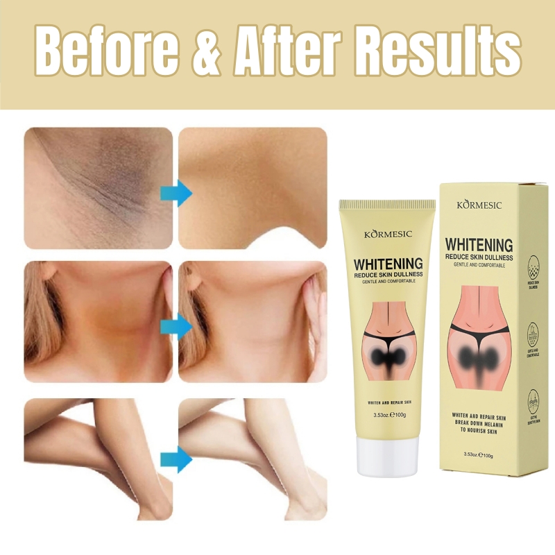 KORMESIC Darkening Bleach Cream Niacinamide Body Whitening Cream Darkening Bleach Private Parts Underarm Inner Thigh Intimate Bleaching Serum Whiten Knee Butt Knuckles Brighten Cream Armpits