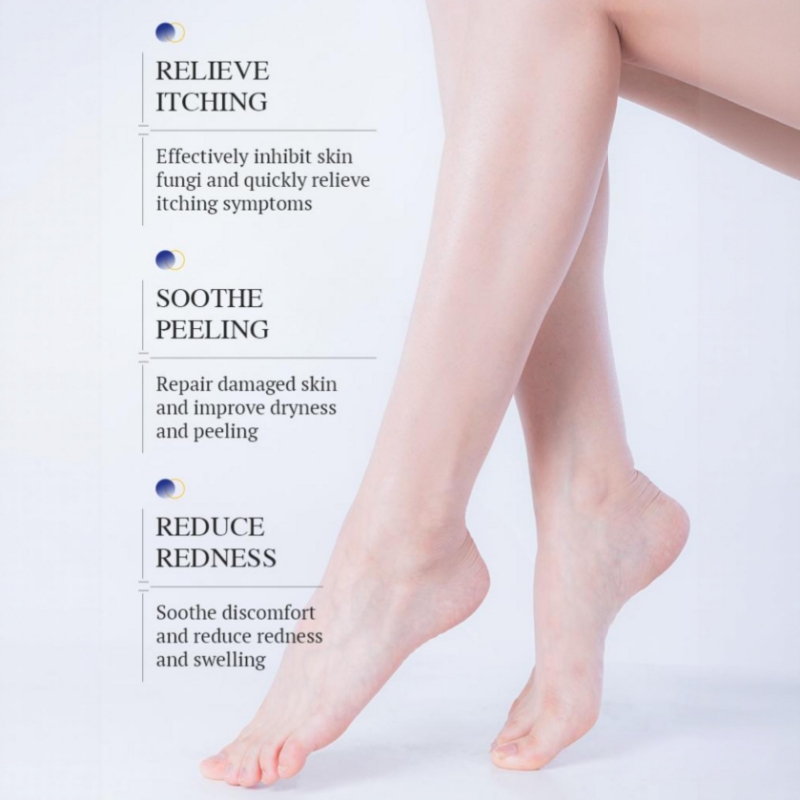 KORMESIC Foot Antifungal Cream – Fast Relief Foot Fungal Infections | Relieves Itching Soothes Peeling Skin & Reduces Redness | OTC Topical Treatment for Toe & Foot Fungus | Effective Daily Foot Care