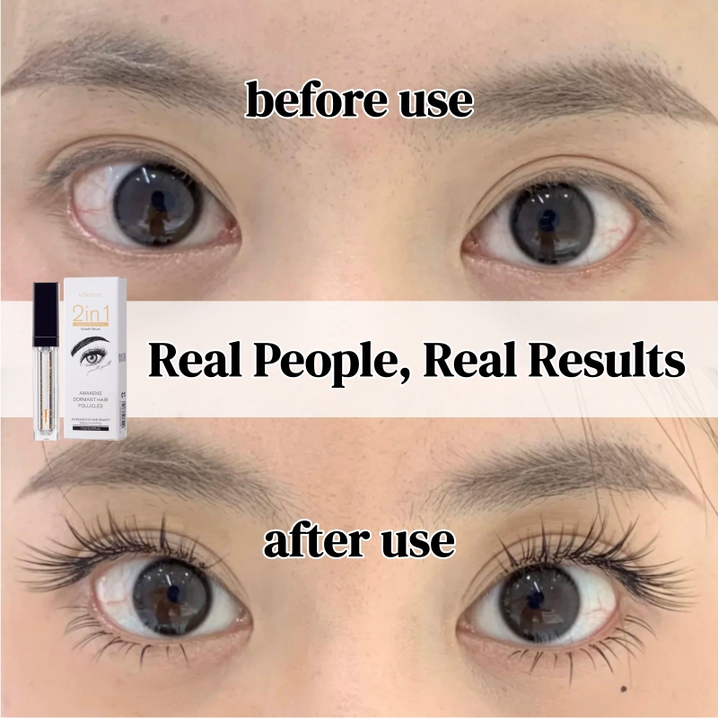 KORMESIC Natural Longer Eyelash Serum Longer Thicker Eyelashes Fuller Eyelashes Eyelash Serum Lash Growth Serum Eyelash Growth Oil Lash Enhancer Lash Growth Treatment Volumizing Lash Serum 30ml