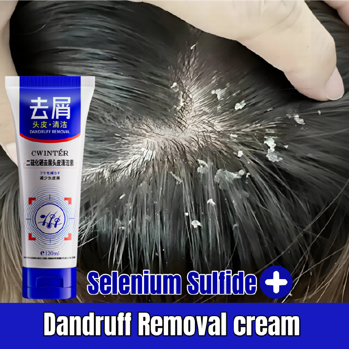 Selenium Sulfide Super Anti-Dandruff Shampoo - Dandruff Killer & Oil Control Scalp Cleanser Hair Care- Medicated Formula for Severe Dandruff & Oily Scalp Leave Hair Fresh Strong Anti-Dandruff Shampoo