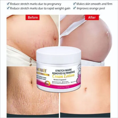 DR MEINAIER Stretch Mark Removed & Skin Firming Cream Anti Stretch Marks 150g