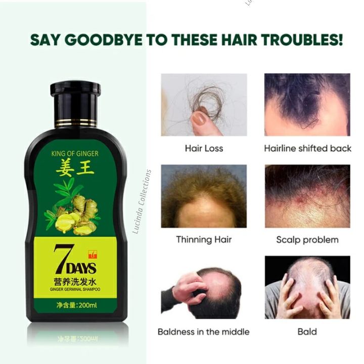 Oil + Shampoo - King Of Ginger 7 Days Ginger Germinal Hair Growth Repair Nourish Root Nutrition Care - Aichun Beauty