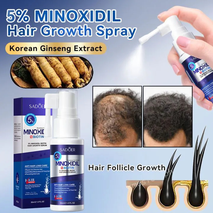 SADOER 5% Minoxidil + Biotin Hair Growth Serum Spray 30ml - Anti Hair Loss Care Treatment for Men & Women (Beard & Hair Regrowth)
