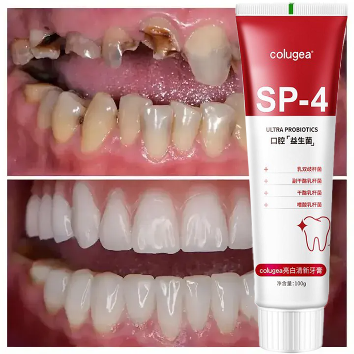 Probiotic Caries Toothpaste SP4 Whitening Repair Tooth Decay Paste Cleaner Teeth Remover Plaque Fresh Breath Oral Care