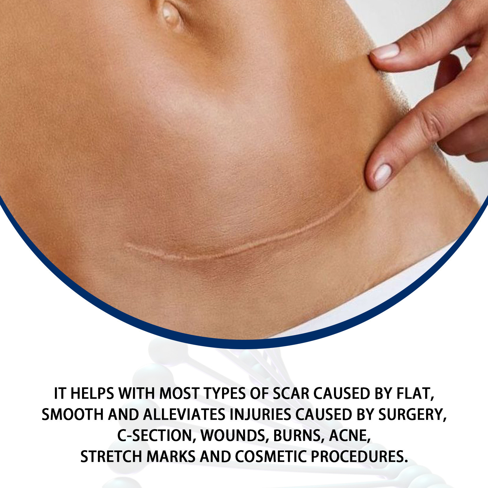 Silicone Scar Removal Gel Removal Skin Scars Cream Treat Surgery Scars Stretch Marks Acne Pox Prints Burn Repair Facial Care Gel Whitening Pigmentation Corrector