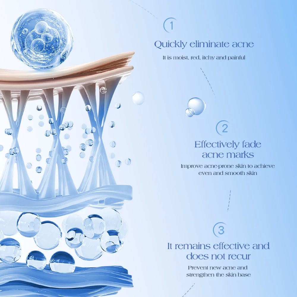 TWG Salicylic Acid Anti Acne Cream Improve Acne Skin Nourishing Moisturizing Face Cream Fading Pimple Scars