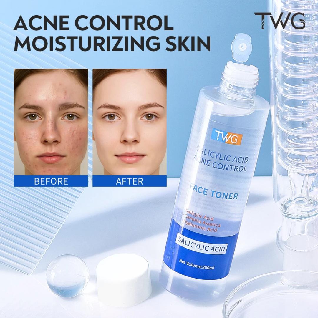 TWG Salicylic Acid Acne Control Face Toner (200 ml).