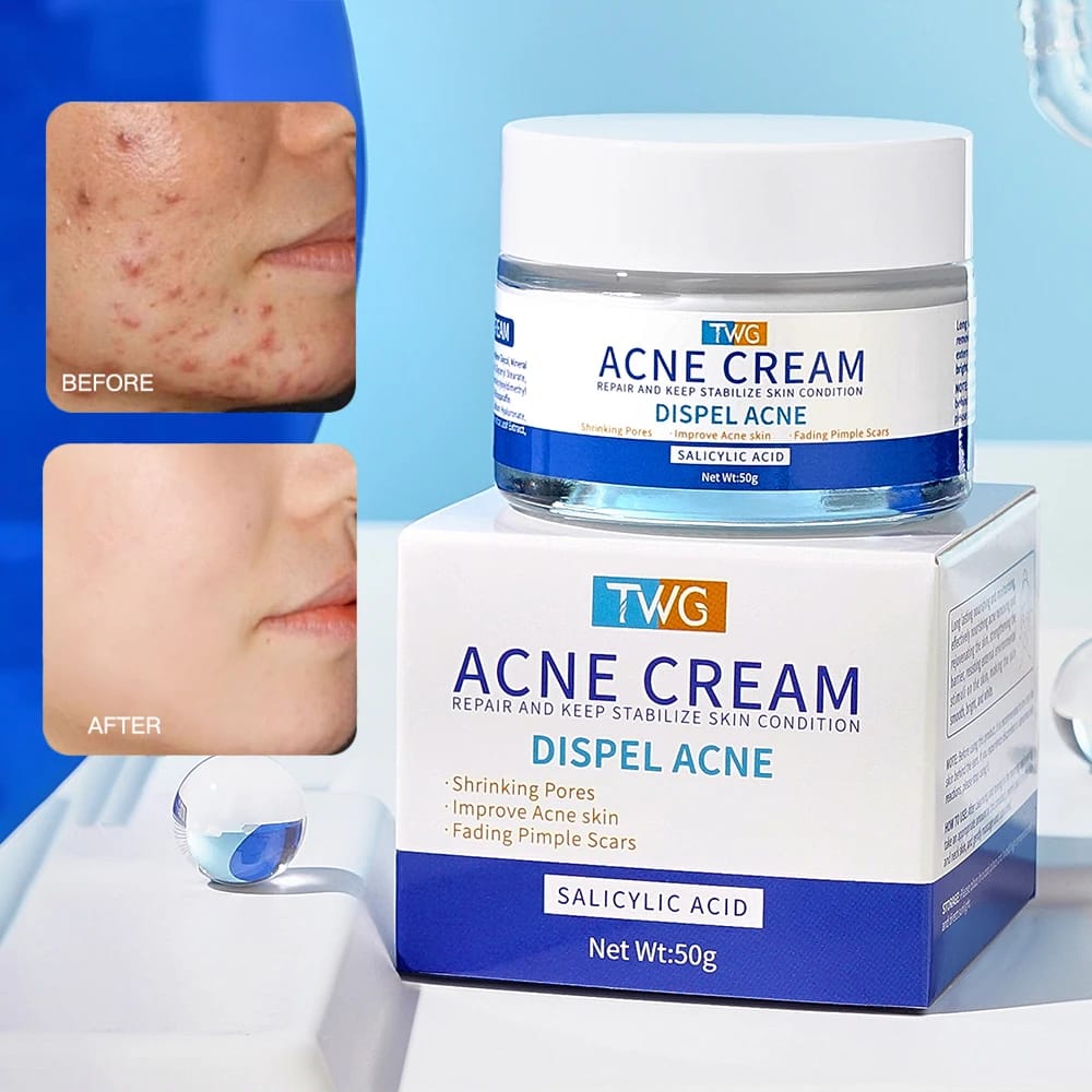 TWG Salicylic Acid Anti Acne Cream Improve Acne Skin Nourishing Moisturizing Face Cream Fading Pimple Scars
