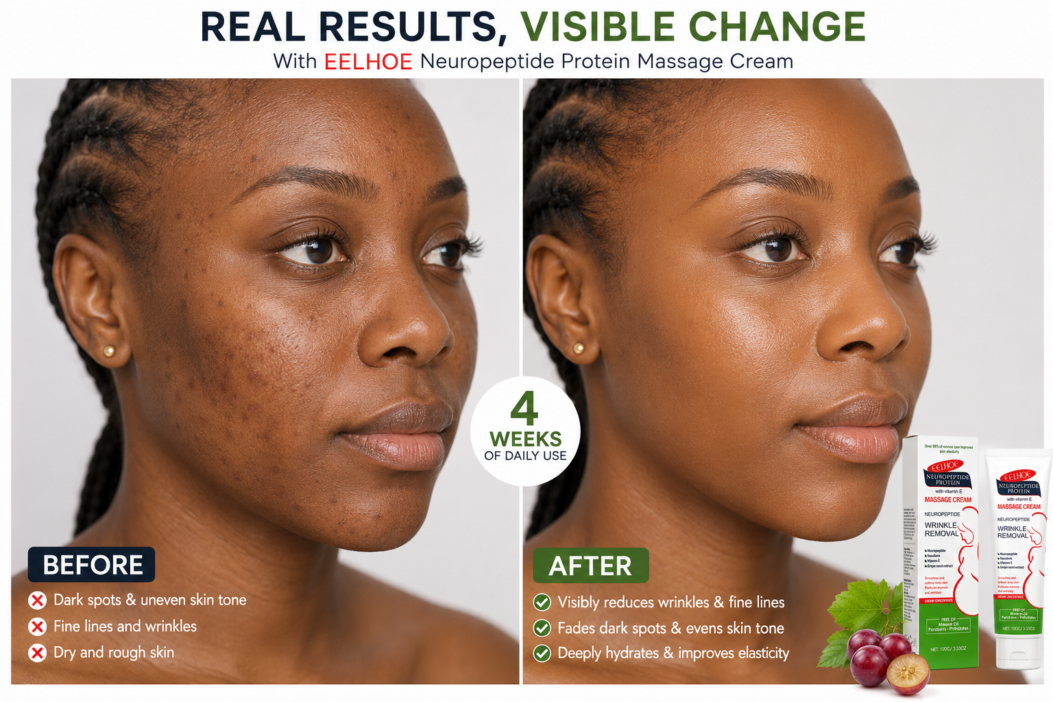 NeuroPeptide Protein Massage Cream for Wrinkle Remover | stretchmarks removal cream– Vitamin E, Squalane & Grape Seed Extract Anti-Aging Moisturizing Cream 100g