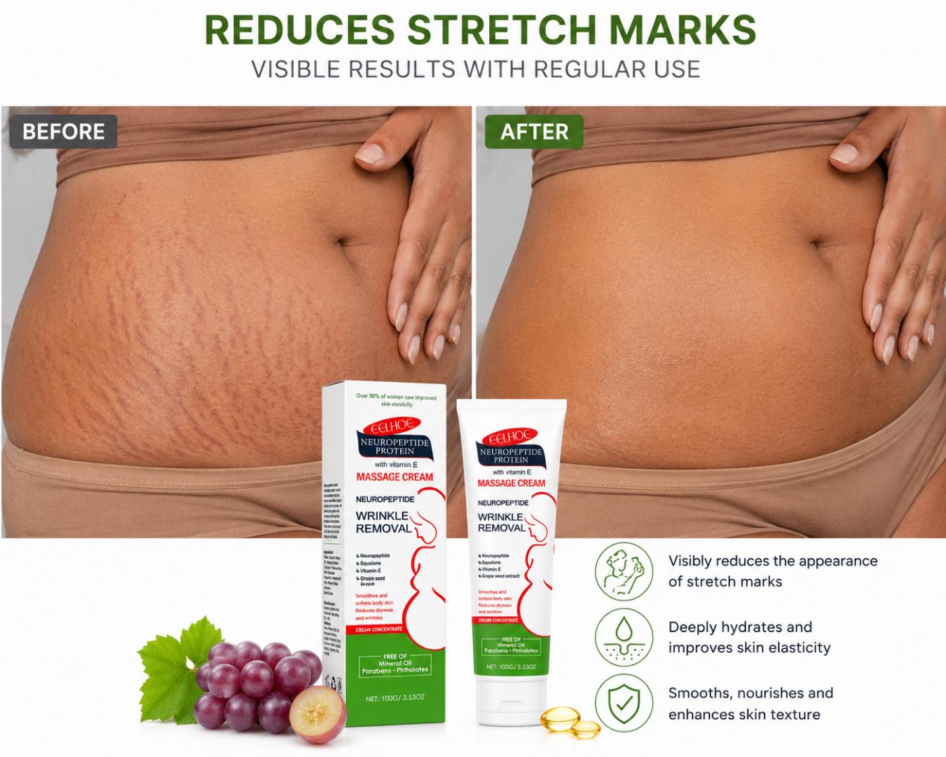 NeuroPeptide Protein Massage Cream for Wrinkle Remover | stretchmarks removal cream– Vitamin E, Squalane & Grape Seed Extract Anti-Aging Moisturizing Cream 100g