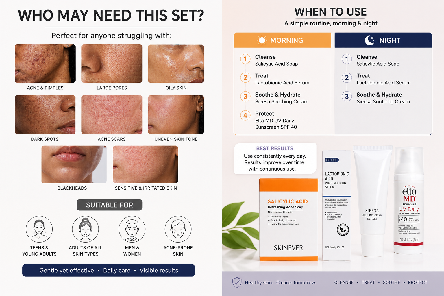 4 in 1| Pore refining| skin smootheninganti acne Acne Treatment Skincare Set Salicylic Acid Soap Lactobionic Acid Serum Soothing Face Cream SPF 40 Sunscreen for Pimples Dark Spots Oily Skin Acne Scars