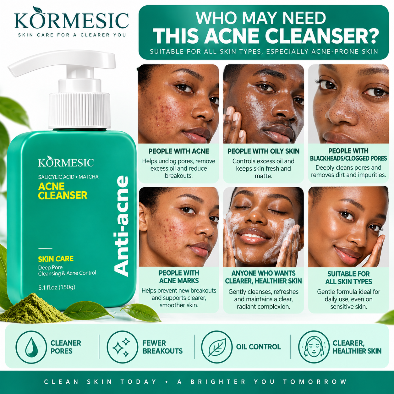 KORMESIC Salicylic Acid + Matcha Acne Cleanser 150g Face Wash Deep Pore Cleansing Acne Control Blackhead Oil Control Facial Cleanser for Oily Acne-Prone Skin