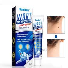 Sumifun Warts Remover Antibacterial Ointment Wart Treatment Cream Skin Tag Remover Herbal Extract Corn Plaster Warts Ointment