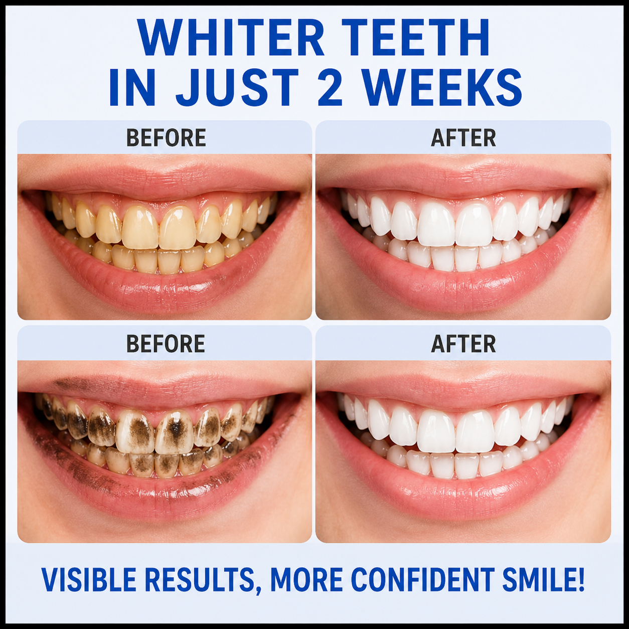 50g Teeth Whitening Powder Remove Plaque Smoke Tea Coffee Stains Tooth Cleaning Powder Fresh Breath Oral Care Tooth Polish Whitener Dental Cleaning Powder for Yellow Teeth Stain Removal Tool