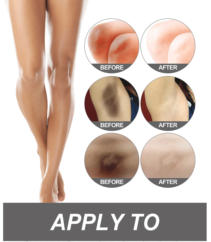 Body Blackening CreamUnderarm and Thigh Darkening Cream Whitening