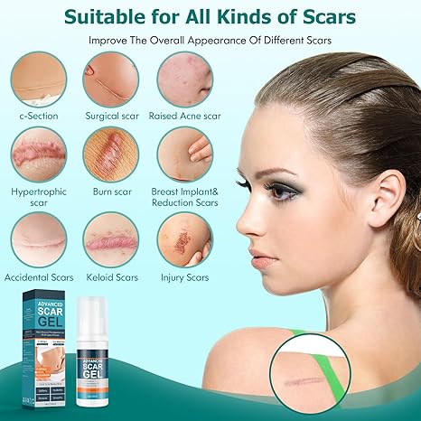 Scar Cream Silicone Scar Gel Medical Grade Scar Gel Facial Care Gel Pigmentation Corrector for Surgical skin Scars Hypertrophic Keloid C-Section Burn Old and New Scars Professional Scar Removal Gel