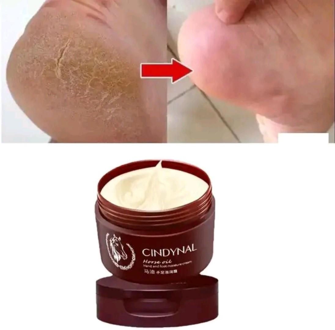 ​[ORIGINAL] Cindynal Horse Oil Cracked Heel Repair Cream (100g) – Deep Moisture with Urea & Shea Butter for Soft, Smooth Feet.