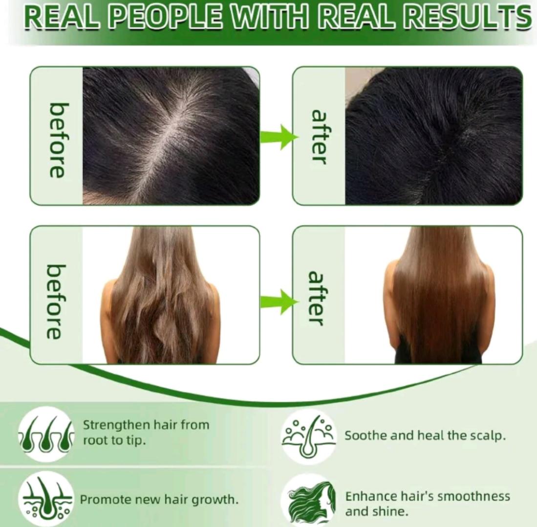 [100% ORIGINAL] Pure Raw Batana Oil for Fast Hair Growth & Anti-Hair Loss (120ml) – For men and women. Local dispatch