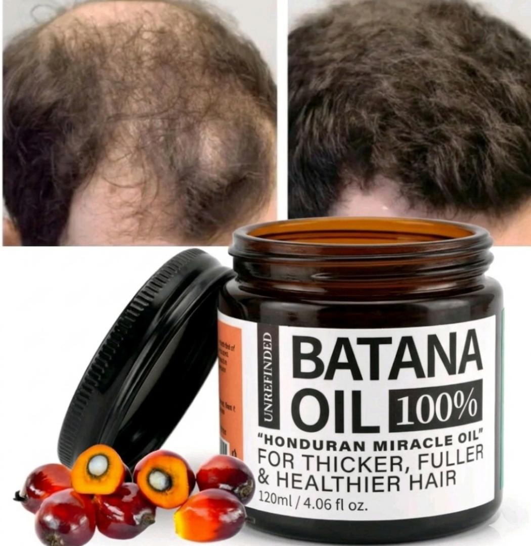 [AUTHENTIC] Organic Raw  Batana Hair Growth Oil (120mls) for Fast Hair Growth,thick and shiny  and Hair Loss Repair for Men and Women. (DISCOUNTED)
