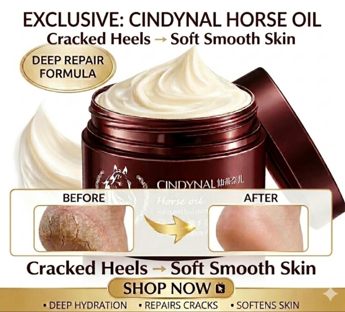​[ORIGINAL] Cindynal Horse Oil Cracked Heel Repair Cream (100g) – Deep Moisture with Urea & Shea Butter for Soft, Smooth Feet.