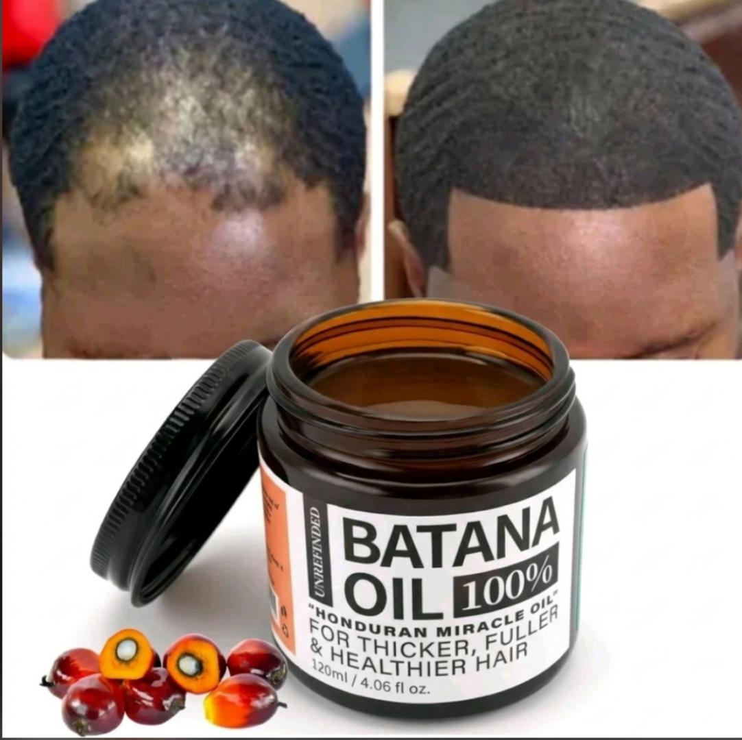 [100% ORIGINAL] Pure Raw Batana Oil for Fast Hair Growth & Anti-Hair Loss (120ml) – For men and women. Local dispatch