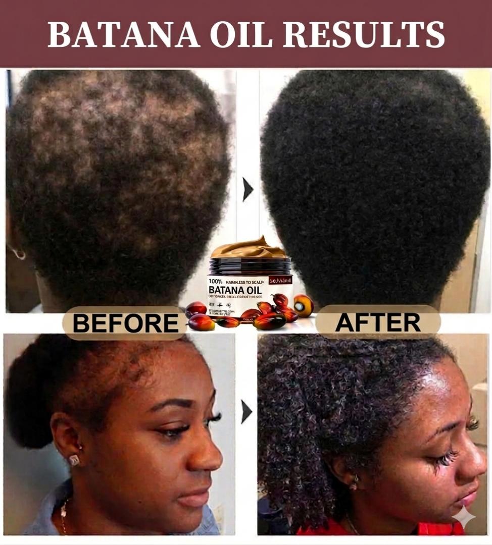 [100% ORIGINAL] Pure Raw Batana Oil for Fast Hair Growth & Anti-Hair Loss (120ml) – For men and women. Local dispatch