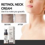 IREV Retinol Anti-Wrinkle Neck Cream Niacinamide Moisturizing Anti-Wrinkle Dark Spot Removal Neck Care Cream 50ml