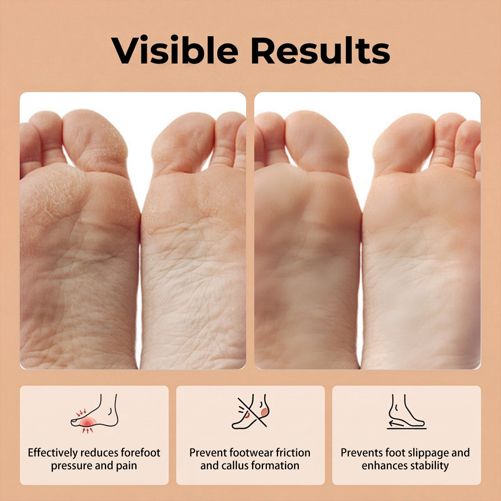 High heel forefoot pads, soft and comfortable, non-slip and anti-shift, secure, lightweight, easy to carry, thin, refreshing, skin-friendly, washable