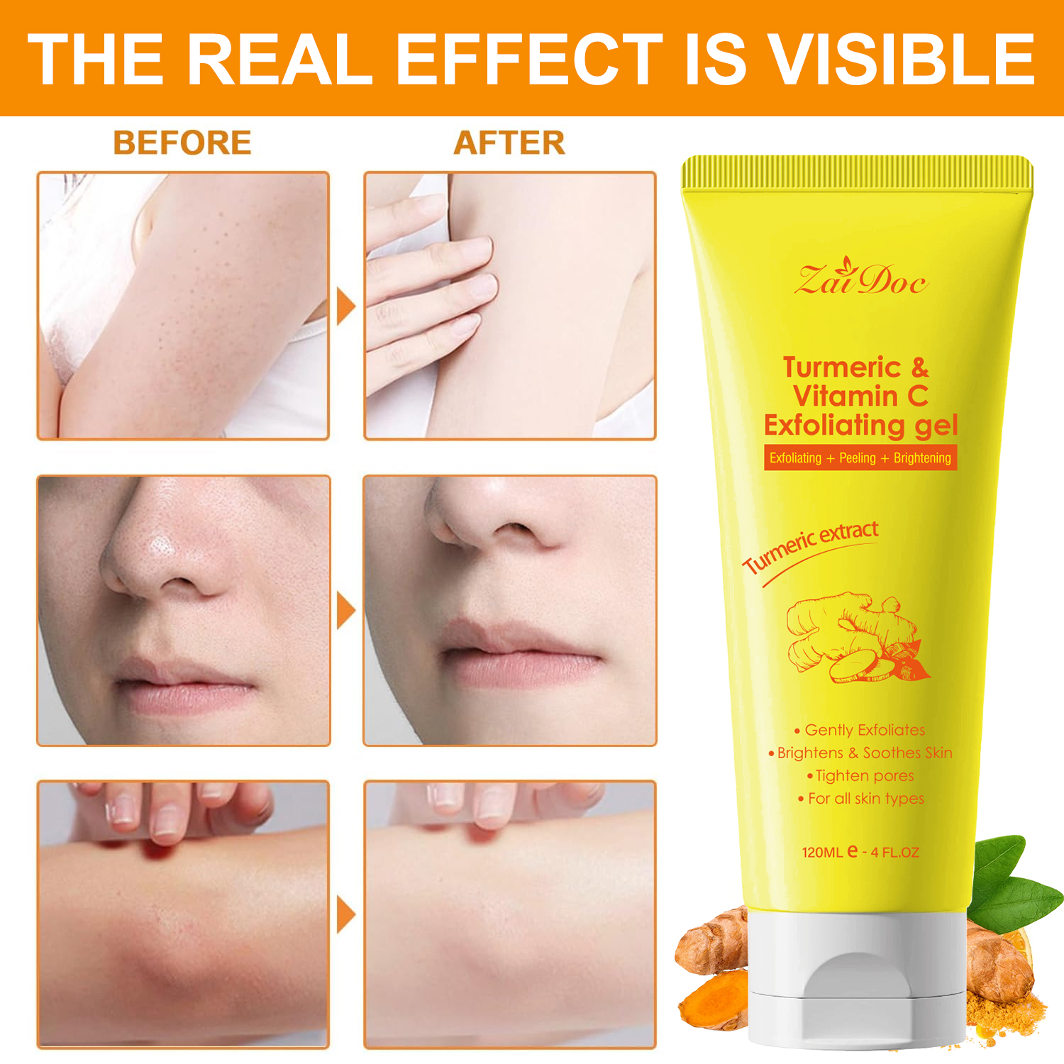 Zaidoc 120ml Turmeric & Vitamin C Exfoliating Gel - Skin Brightening Peeling Gel for Deep Pore Cleaning, Dark Spot Removal & Glowing Skin