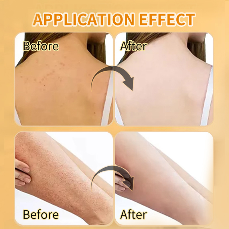 Amococo 280g Turmeric Body Glow Scrub - Deep Exfoliating & Brightening Salt Scrub for Dark Spots, Acne & Smooth Skin, Natural Skin Whitening Treatment