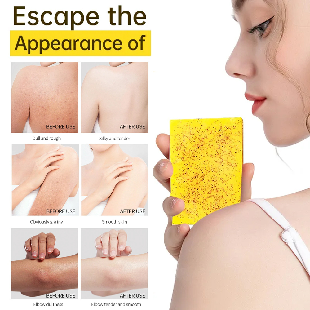 Amococo 100g Turmeric & Kojic Acid Brightening Soap with Foaming Net - Natural Skin Glow, Dark Spot Remover & Deep Cleansing Bar Soap