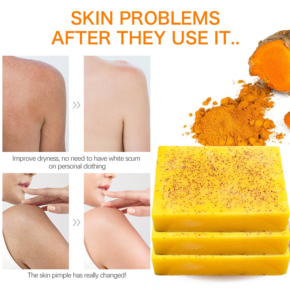 Amococo 100g Turmeric & Kojic Acid Brightening Soap with Foaming Net - Natural Skin Glow, Dark Spot Remover & Deep Cleansing Bar Soap