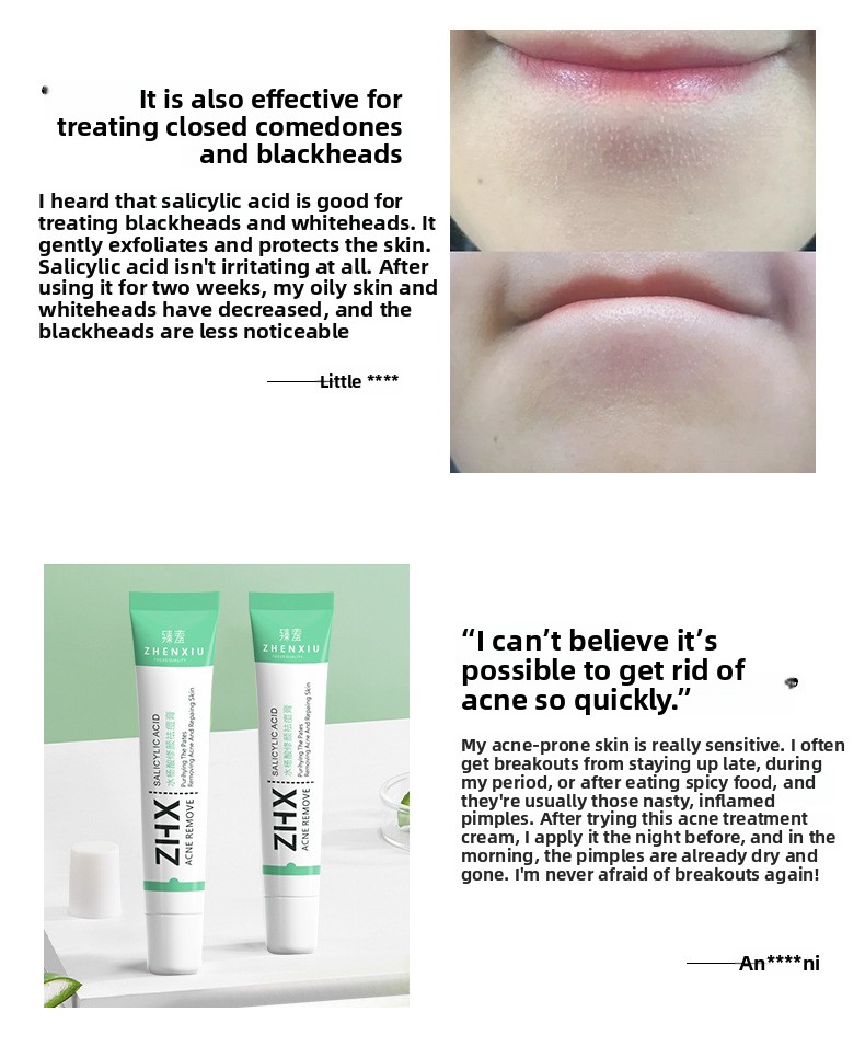 Salicylic Acid Acne Removal Cream, Pimple & Blackhead Spot Treatment, Fade Acne Marks, Oil Control & Gentle Skin Repair for Face