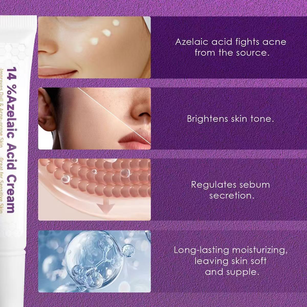15% Azelaic Acid Blemish Removal Cream, 15% Azelaic Acid Facial Cream 20g, Niacinamide Vitamin C, Reduce Acne & Dark Spots, Skin Redness Relief