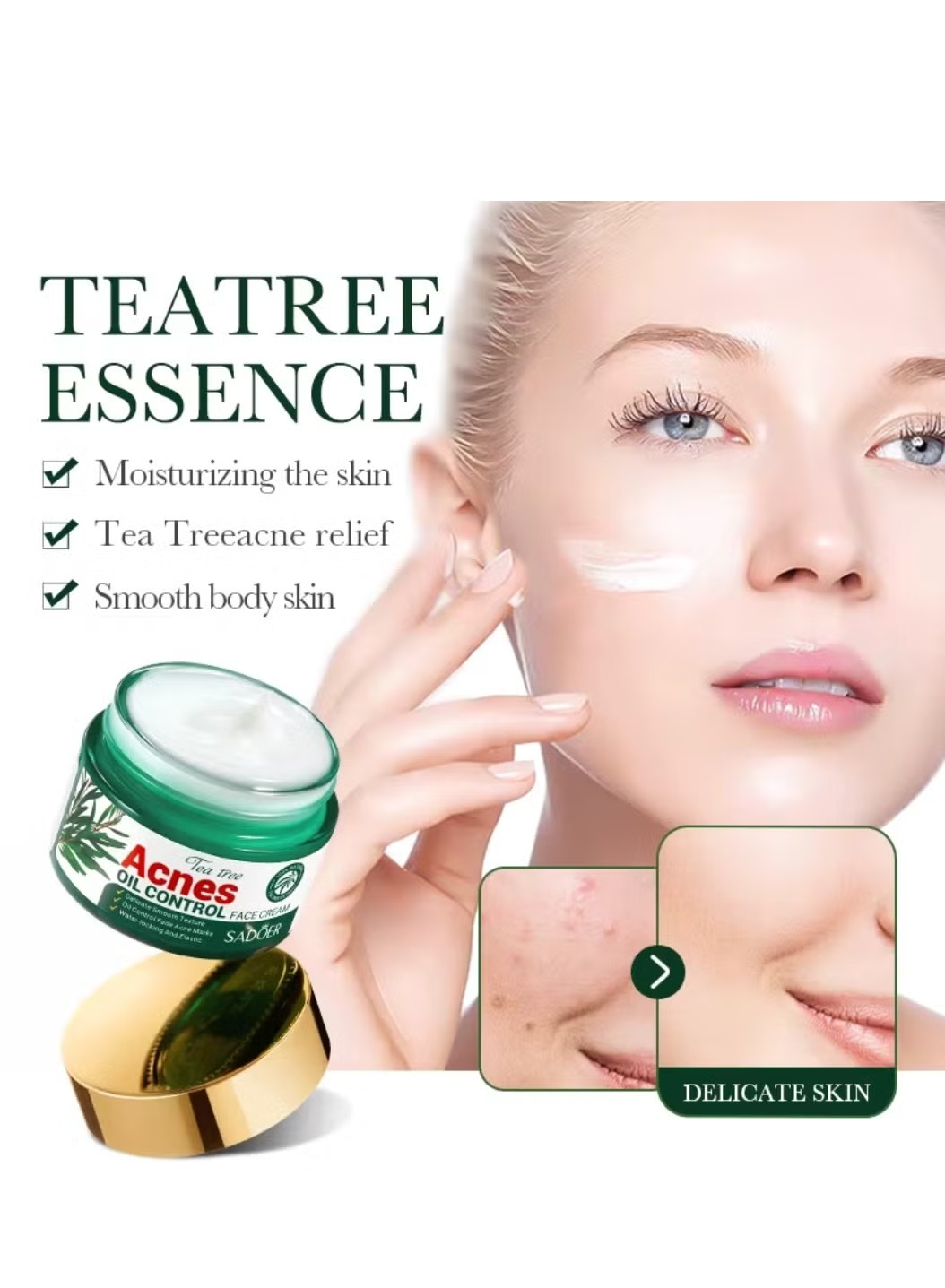 SADOER Tea Tree Acne Oil Control Face Cream - Original Tea Tree Essential Anti-Acne, Fade Acne Marks & Water-Locking Moisturizer MOKS