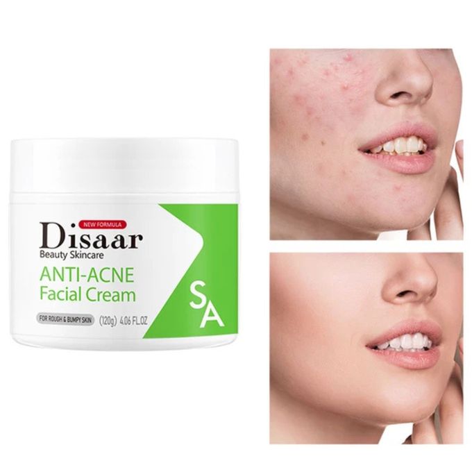 Disaar Anti Acne Facial Cream 120g Whitening Repair Moisturizing Face Cream Fade Acne Marks Oil Control Soothing Anti Inflammatory Hydrating Smooth Clear Skin Treatment For Women And Men