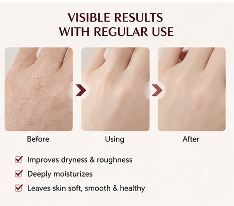 CINDYNAL Horse Oil Moisturizing Hand & Foot Cream for Dry Cracked Skin Repair 120g