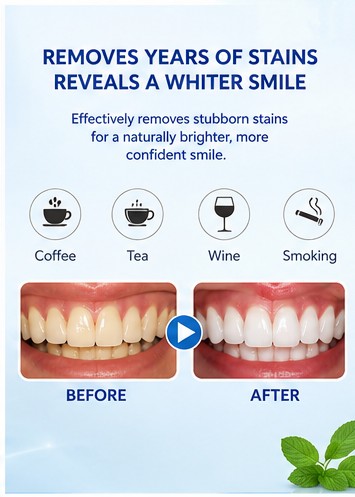 5D White Teeth Whitening Strips – 28 Enamel-Safe Whitening Strips for 14-Day Treatment, Removes Coffee Tea Wine and Smoking Stains, Visible Results in 3 Days, Easy At-Home Teeth Brightening Kit