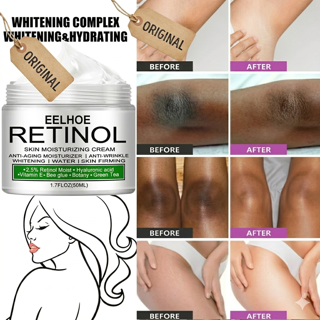 Body Whitening Cream Underarm Knee Buttocks Private Bleach Remove Melanin Pigmentation Improve Dull Nourish Brighten Skin Care AUTOYSUR EELHOE Dark Armpit Whitening Cream - Underarm Lightening Cream .