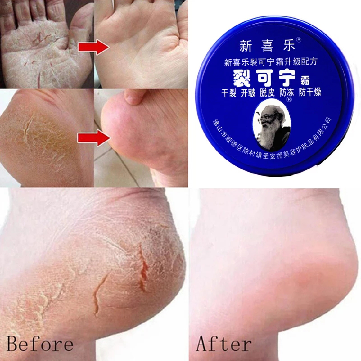 85g Anti Crack Foot Cream Dryness Foot Mask Heel Cracked Repair Cream Hand Mositurizing Removal Callus Dead Skin Hands Feet Care Anti freezing and Anti cracking Foot Cream 85g Hand Cream Moisturizing.