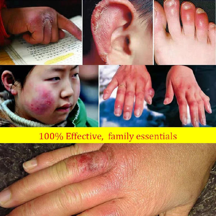 85g Anti Crack Foot Cream Dryness Foot Mask Heel Cracked Repair Cream Hand Mositurizing Removal Callus Dead Skin Hands Feet Care Anti freezing and Anti cracking Foot Cream 85g Hand Cream Moisturizing.