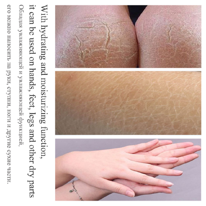 85g Anti Crack Foot Cream Dryness Foot Mask Heel Cracked Repair Cream Hand Mositurizing Removal Callus Dead Skin Hands Feet Care Anti freezing and Anti cracking Foot Cream 85g Hand Cream Moisturizing.