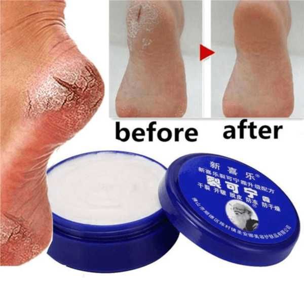 85g Anti Crack Foot Cream Dryness Foot Mask Heel Cracked Repair Cream Hand Mositurizing Removal Callus Dead Skin Hands Feet Care Anti freezing and Anti cracking Foot Cream 85g Hand Cream Moisturizing.