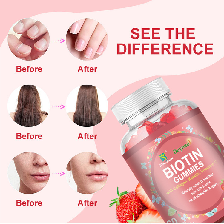 Daynee Biotin Gummies for Hair Growth | Max Strength Biotin 10000mcg Prevents Thinning and Loss | Chewable Biotin Supplement for Women Men and Kids | 100 Count Vegan Hair Gummies for Hair Skin & Nails