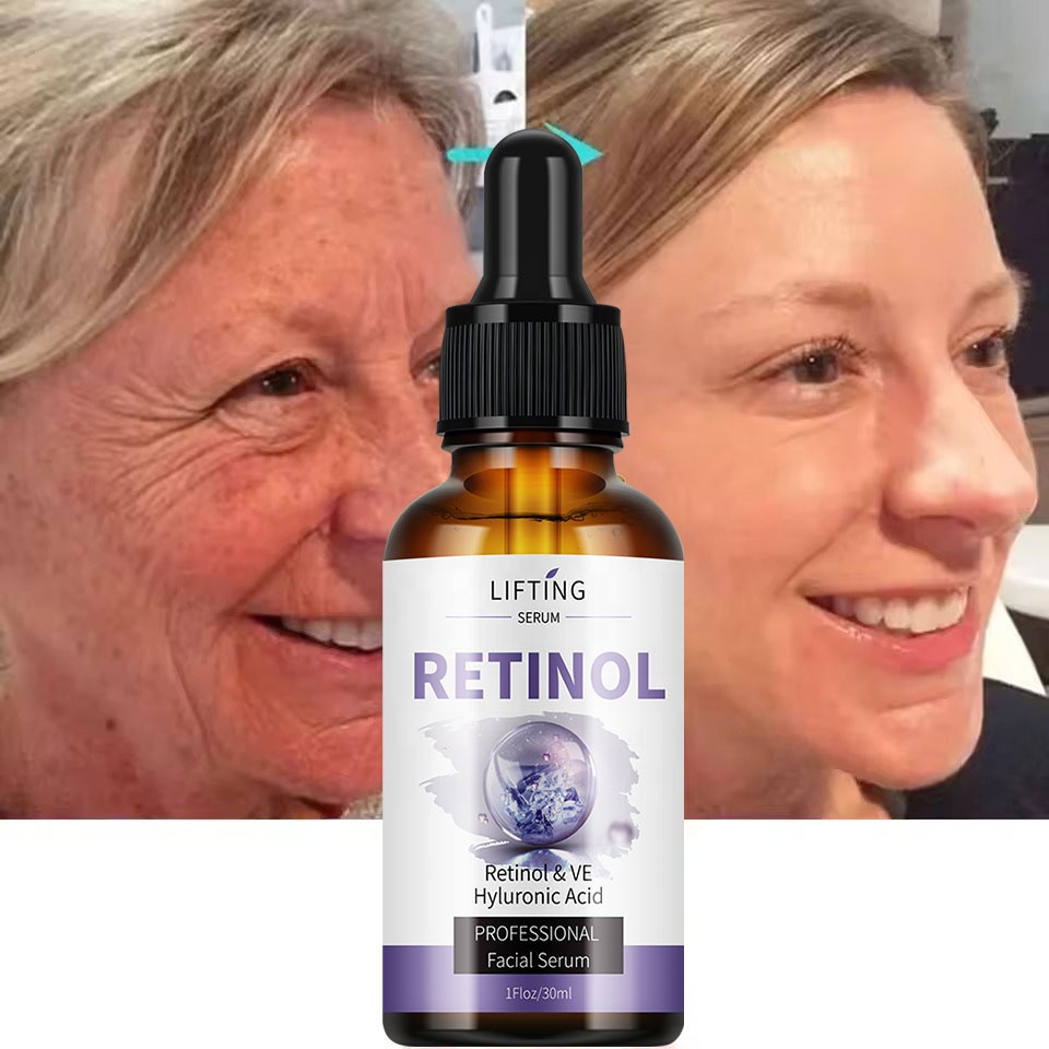 LIFTING Retinol Facial Serum 30ml, Retinol, Vitamin E and Hyaluronic Acid Face Serum for Hydration and Skin Care, Lightweight Anti-Aging Moisturizing Serum for Smooth, Firm and Healthy-Looking Skin  .