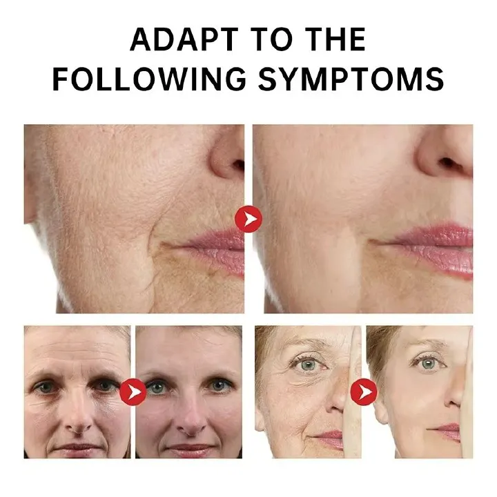Hyaluronic Acid Retinol Face Cream Anti-wrinkle Cream Reduces Fine Lines Anti-aging Lotion Remove Skin Spots Firming Facial Cream
