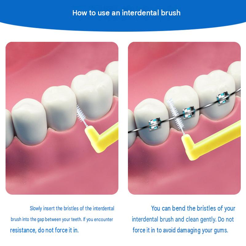 L-Shaped Interdental Brush (Pack of 10) – Wire-Bristle Brush for Cleaning Between Teeth