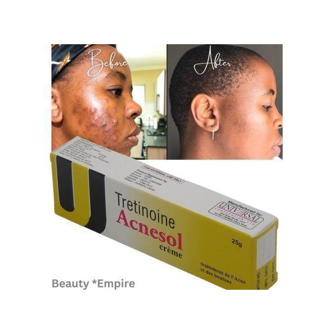 Acnesol tretinoin Cream 25g - Powerful Acne Treatment For Clearer, Smoother SkinSkin damage
Fade Acne Scars,Brighten,Glow,Boost Your Skin Beauty Regimen,Better skin products absorption.